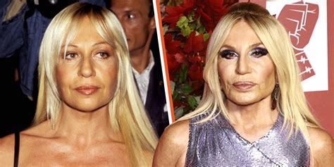 donna versace now|what happened to donatella versace's face.